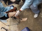 A Haitian in need of a prosthetic receives help through Service Chretien d'Hait's disabilities program